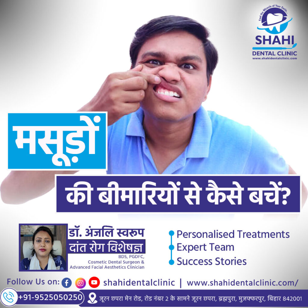 Healthy gums and teeth with tips to prevent gum disease