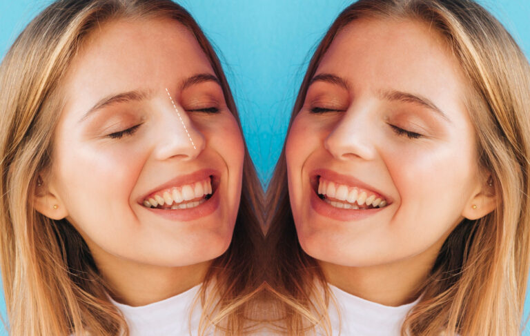 Cosmetic dentistry smile makeover with teeth whitening and veneers in a modern dental clinic