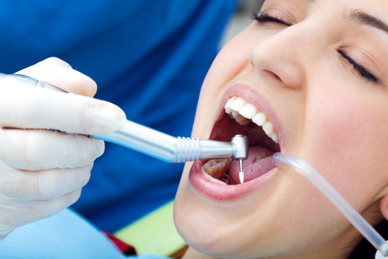 Dentist performing professional teeth cleaning to maintain a healthy mouth and gums