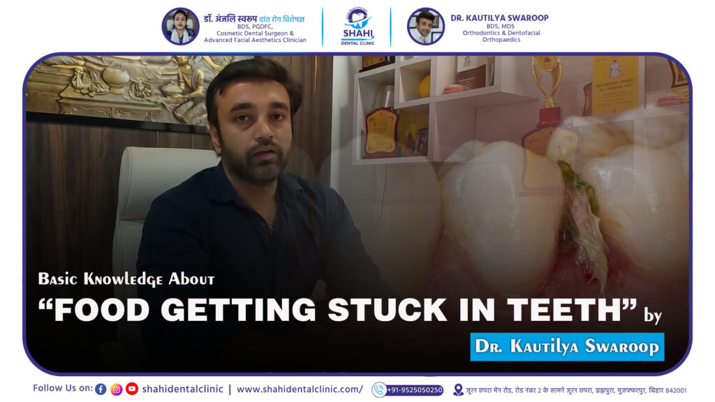 Best Dentist in Muzaffarpur, Root Canal Treatment Muzaffarpur, Dental Filling, Dr. Kautilya Swaroop, Shahi Dental Clinic